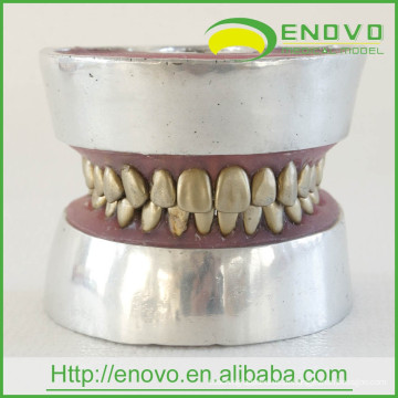 PT-E11 Modelo de Prática de Dente de Dente de Metal para Prática Médica Pré-Operatória